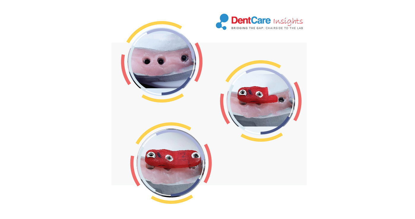 dentcare-global